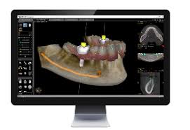digital dental treatment planning